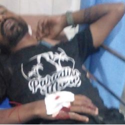 ग्याङ फाइट हुंदा विराटनगरमा १० जना घाइते